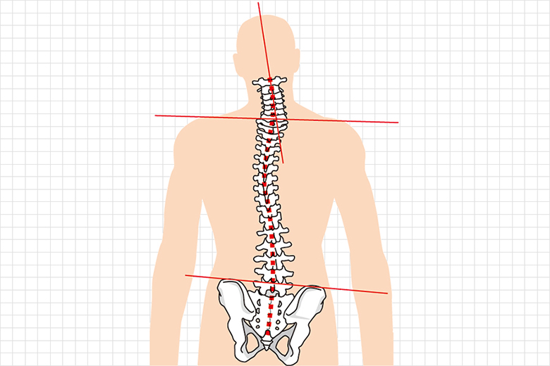 成増で肩こりにお悩みならプラネット鍼灸整骨院